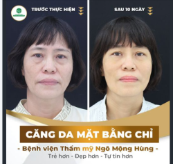 KHÁCH HÀNG TRƯỚC VÀ SAU CĂNG DA MẶT BẰNG CHỈ THAY ĐỔI NHƯ THẾ NÀO?