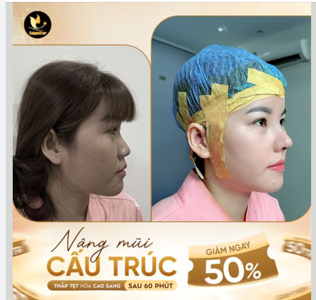 60 PHÚT - MŨI THẤP TẸT BỖNG HÓA CAO SANG