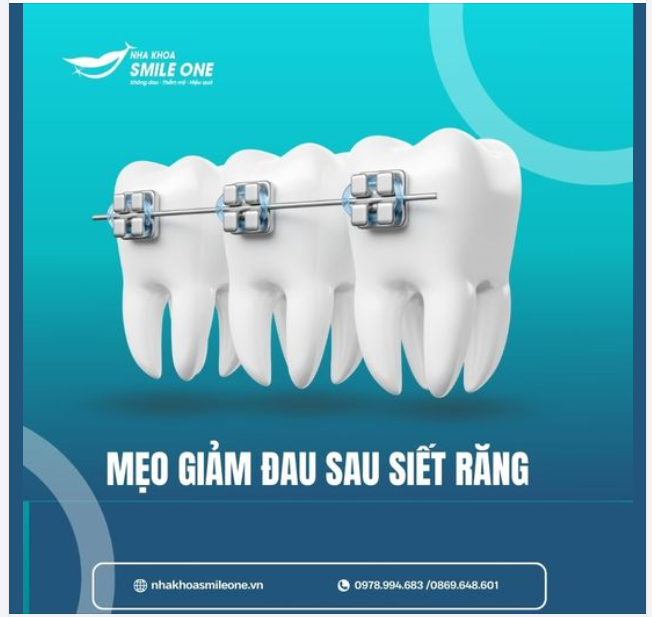 MẸO GIÚP GIẢM ĐAU SAU SIẾT RĂNG TẠI NHÀ!