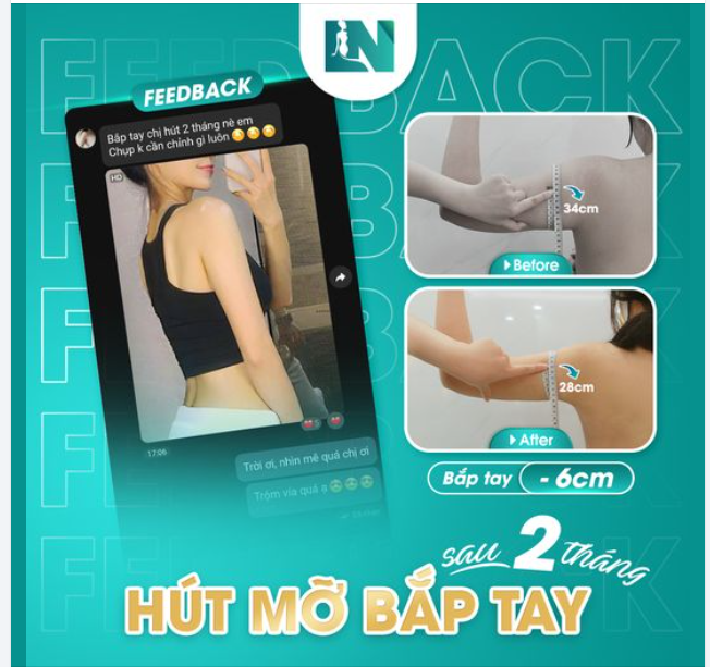 Flex nhẹ feedback từ bạn khách hàng sau hút mỡ bắp tay 1 tháng!