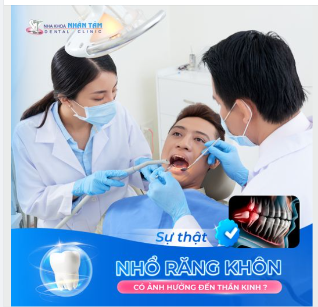 Sự thật nhổ răng khôn có ảnh hưởng đến thần kinh?