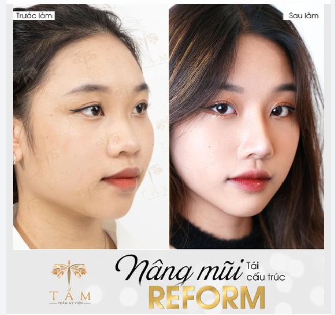 “Bật mí” bí quyết thăng hạng tự tin của Shayda Hot Tiktoker cover ngày nào, nay xuất sắc với 4 chọn tại Rap Việt 4.