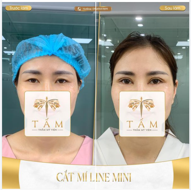 Hình ảnh chân thực của khách hàng sử dụng dịch vụ tại TMV Tấm