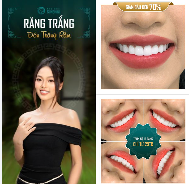 RĂNG TRẮNG ĐÓN TRĂNG RẰM