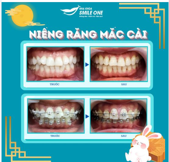 RĂNG HÔ KHẤP KHỂNH ĐANG CẢN LỘ TRÌNH THĂNG TIẾN CỦA BẠN???
