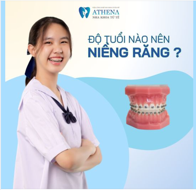 Độn tuổi nào thì nên niềng răng