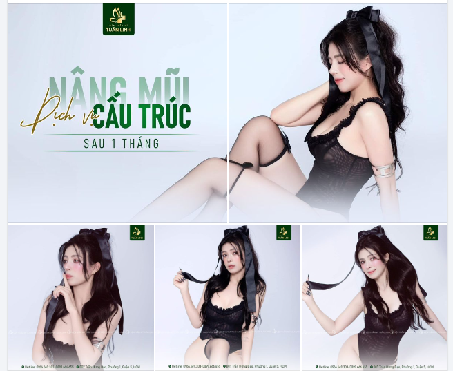 Mũi cao sẽ giúp gương mặt bạn thay đổi như thế nào?
