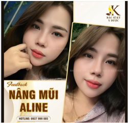 Những ngày nghỉ lễ của chị em thế nào rồi, dành chút thời gian tham khảo thêm một đánh giá sau nâng mũi nữa để có thêm động lực làm đẹp nhé.