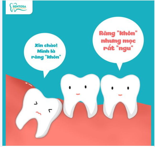 LÀ RĂNG “KHÔN” - NHƯNG CÓ THẬT SỰ “KHÔN”?