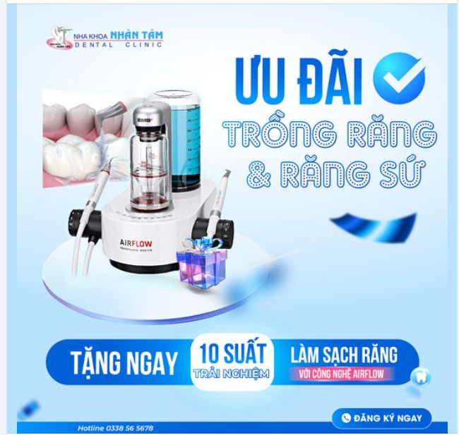 Tặng 10 gói trải nghiệm làm sạch răng không đau