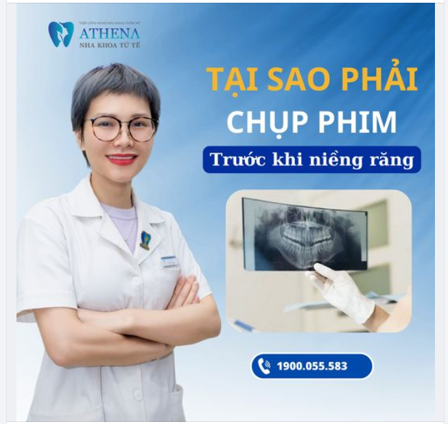 Tầm quan trọng của việc Chụp X-quang khi niềng răng