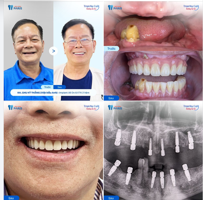 Niềm tin, thời gian hay sức khỏe,... đâu là thứ khiến bạn cảm thấy dù bỏ nhiều tiền cũng chẳng thể có được như lúc ban đầu?