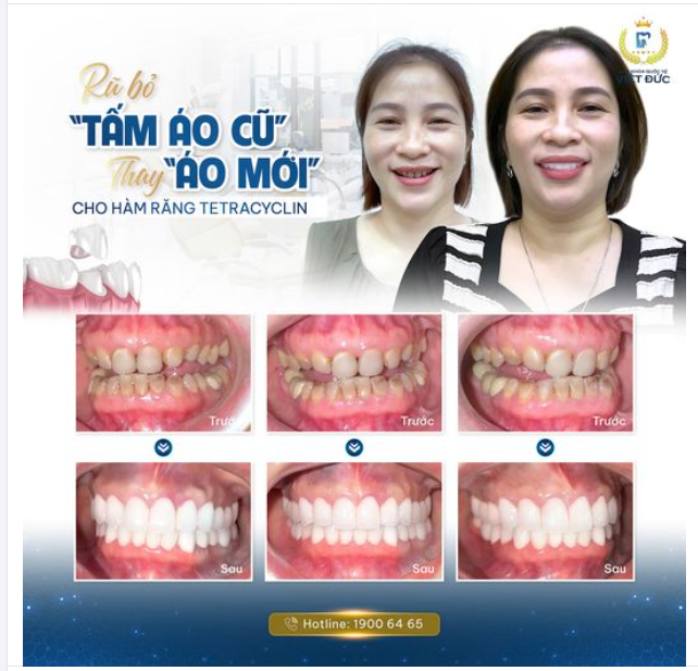 CHÀO ĐÓN NỤ CƯỜI MỚI RẠNG NGỜI