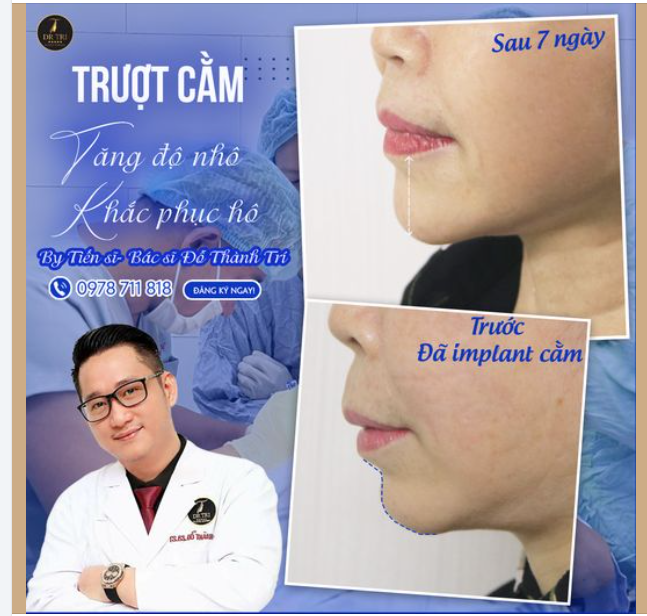 Không bao giờ là quá muộn để làm đẹp!