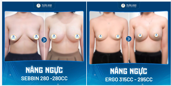 Thay Đổi Để Tự Tin Tỏa Sáng!