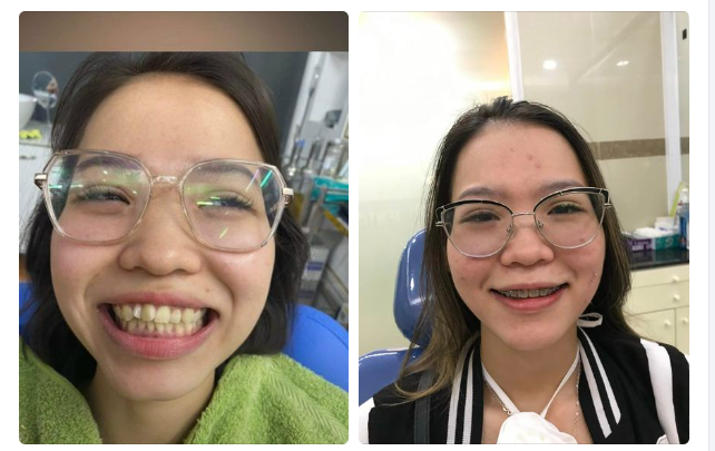 THĂNG HẠNG NHAN SẮC THÊM TỰ TIN