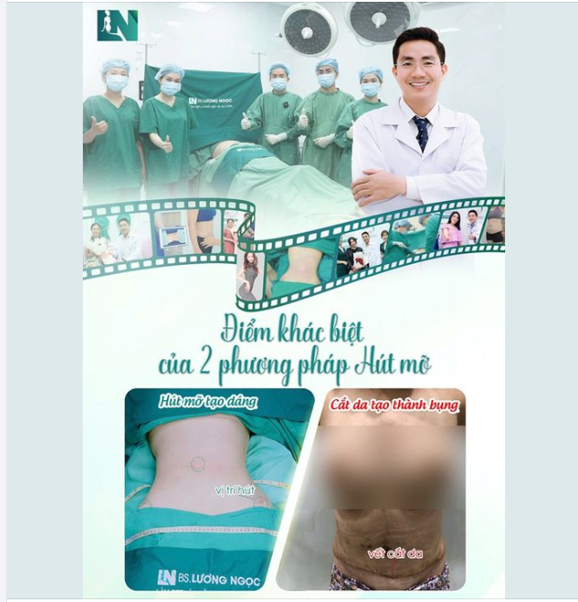 Nhiều bạn thắc mắc vì sao hút mỡ tạo dáng tại ekip Bác sĩ Lương Ngọc lại được nhiều chị em lựa chọn??