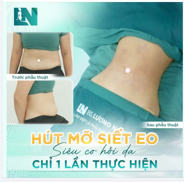 HÚT MỠ - SIẾT EO - GIẢM MỠ NHẸ NHÀNG