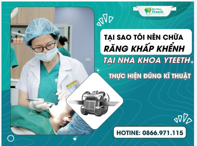 BẠN HỎI TÔI TRẢ LỜI - RĂNG KHẤP KHỂNH: TẠI SAO TÔI NÊN NIỀNG RĂNG TẠI YTEETH Thực hiện niềng răng khểnh đúng kỹ thuật.