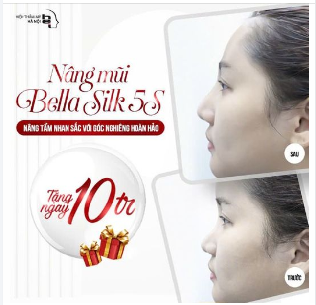 NÂNG MŨI BELLA SILK 5S - GÓC NGHIÊNG HOÀN HẢO