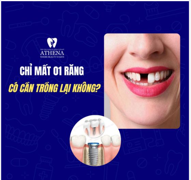 Mất một chiếc răng có trồng lại không?
