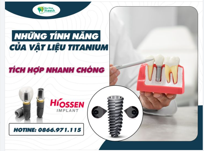 TẠI SAO TITANIUM LẠI ĐƯỢC DÙNG TRONG NHA KHOA - TÍCH HỢP NHANH CHÓNG