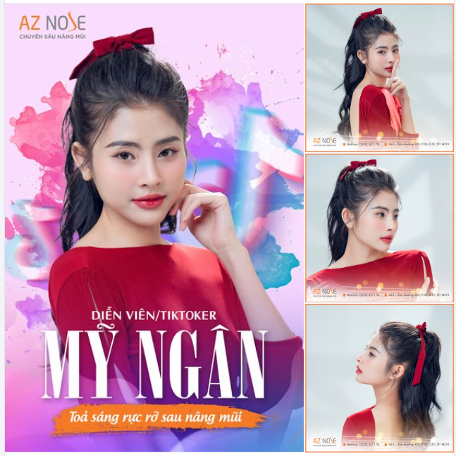 TikToker Mỹ Ngân nhận thành quả "hơn cả mong đợi" sau 2tháng nâng mũi!