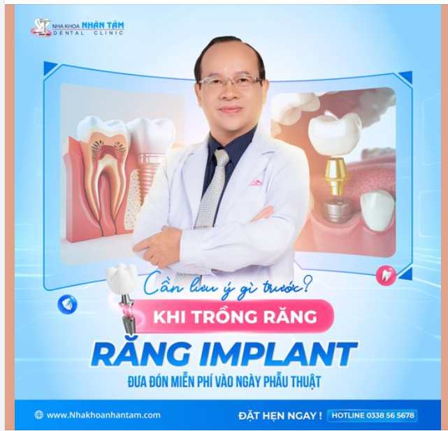 Trồng răng Implant: Đừng bỏ qua những điều quan trọng này!