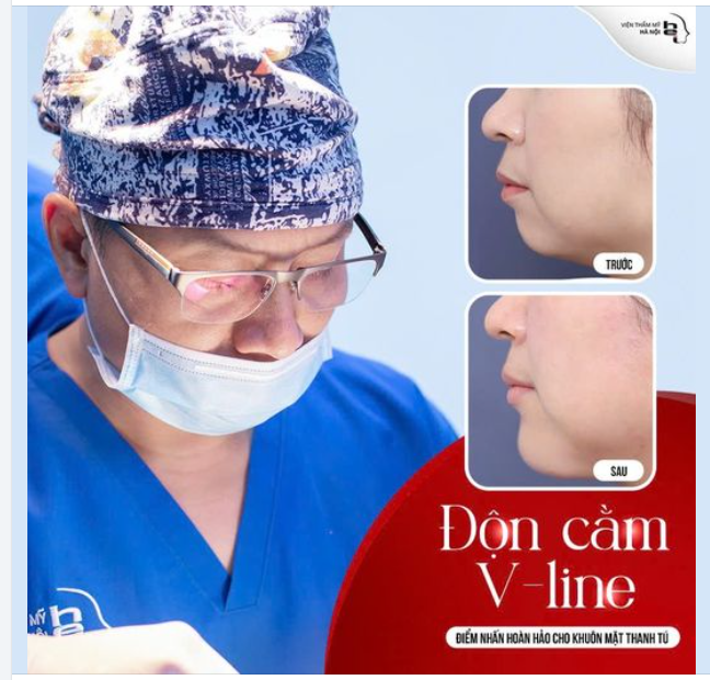 ĐỘN CẰM VLINE kiến tạo VẺ ĐẸP HOÀN HẢO