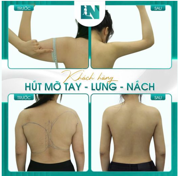 Đối với phụ nữ, phần thân trên nuột nà dễ gây thu hút và tạo sự "nhỏ bé" cần được che chở.