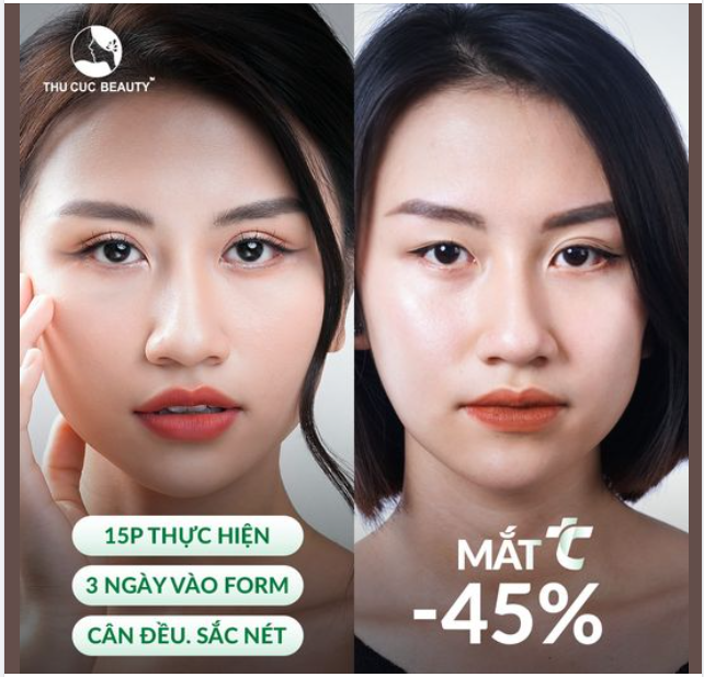 Mí ẩn/nhiều da chùng làm bạn mất tự tin? Mắt TC giúp sở hữu đôi mắt 2 mí to tròn, rõ nét