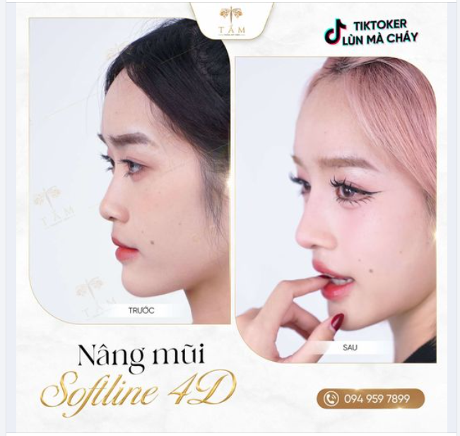 Bí mật đằng sau sự lựa chọn của các hot Tiktoker: Vì sao Thẩm mỹ viện Tấm luôn được "chọn mặt gửi vàng"?