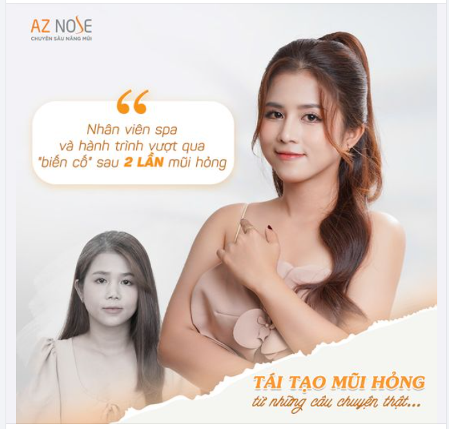“Mình không nghĩ "mũi hỏng" để lại nhiều hệ luỵ đến vậy...”