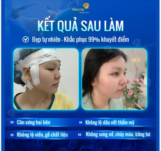 Kết quả sau làm Đẹp tự nhiên  -khắc phục 99% khuyết điểm