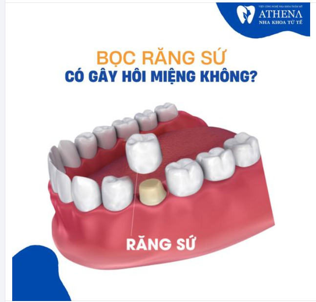 Bọc răng sứ có gây hôi miệng không?