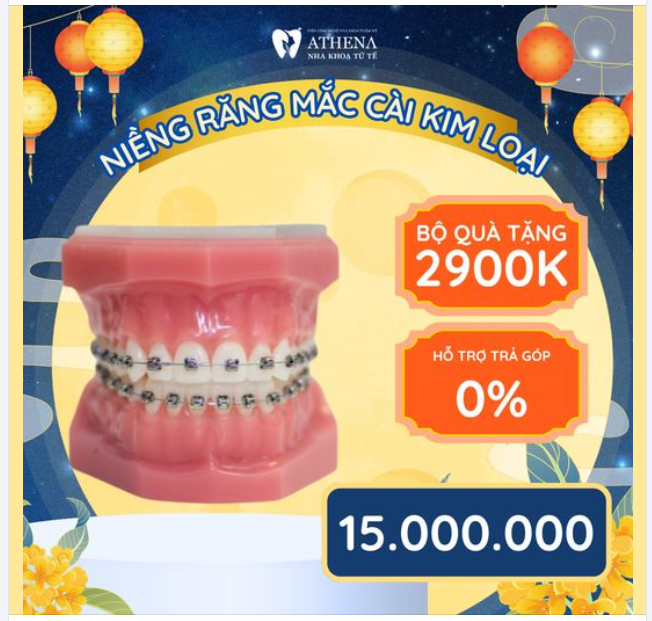 Cơ hội vàng để sở hữu nụ cười hoàn hảo với chương trình niềng răng tại Nha Khoa ATHENA đang sắp kết thúc. Đừng bỏ lỡ!