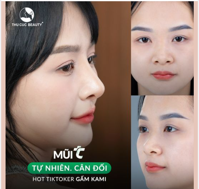 Vì sao Hot Tiktoker Gấm Kami chọn Mũi TC?