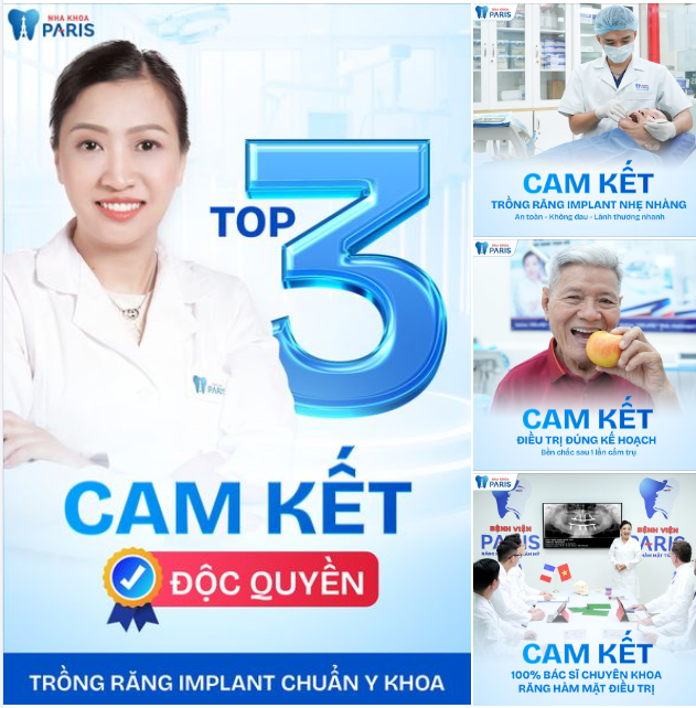 3 CAM KẾT ĐỘC QUYỀN VỀ TRỒNG RĂNG IMPLANT TẠI NHA KHOA PARIS