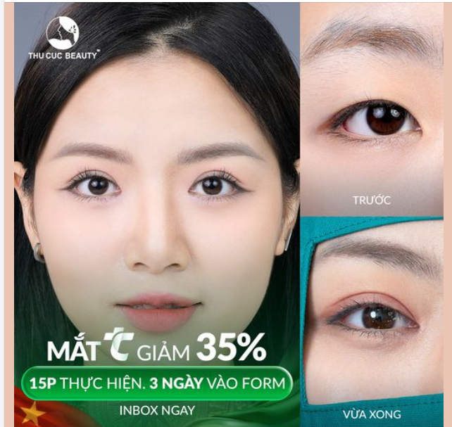 Đón mừng Đại lễ với nếp mí sắc nét, to tròn  cho tất cả các bạn đến với TC cùng chi phí cực hời chỉ từ 5.9Tr 