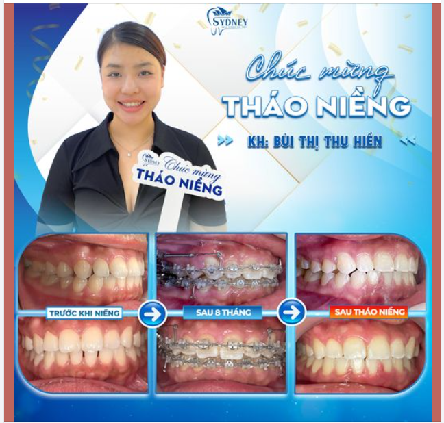CHÚC MỪNG THÁO NIỀNG KH. THU HIỀN