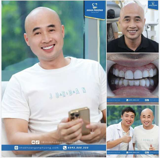 "Biết thế này bọc sứ sớm chứ làm phủ làm gì không biết" - Anh Cường cười sung sướng khi hoàn thành 16 răng sứ.