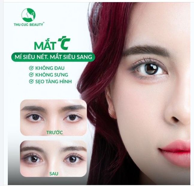 Ưu đãi cắt mí giá gốc tại Tc