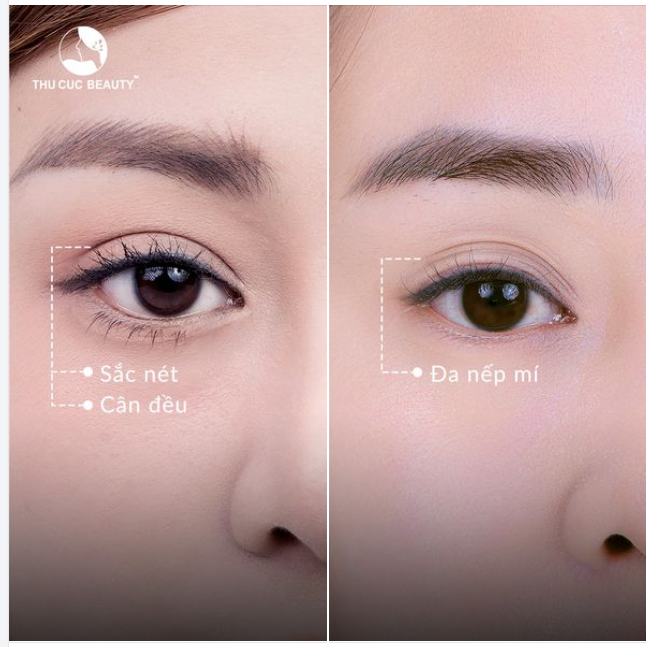 Mí xinh lung linh chỉ sau 7 ngày