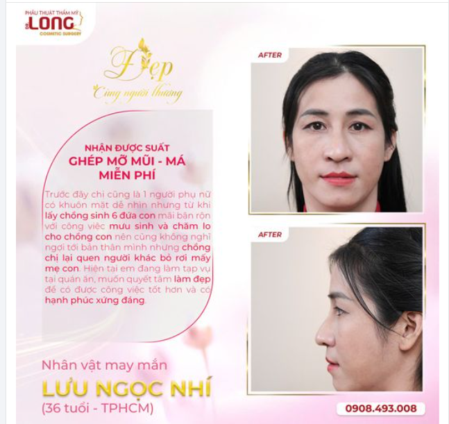 KHÁCH HÀNG MAY MẮN LƯU NGỌC NHÍ (36t, TPHCM) Nhận được suất: Ghép mỡ má - mũi miễn phí