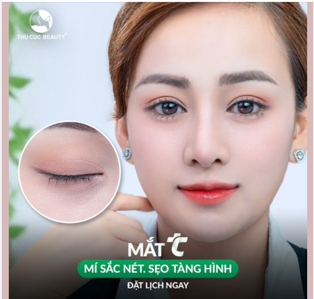 Chỉ mất 15P thực hiện Cắt mí tự nhiên, sẹo tàng hình cùng Mắt TC