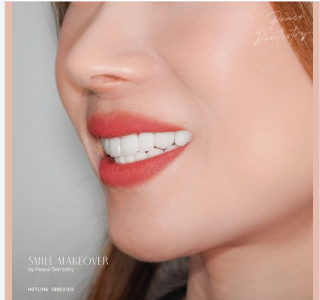 "MẮT THẨM MỸ" CỦA BÁC SĨ LÀ YẾU TỐ QUAN TRỌNG TRONG THẨM MỸ NHA KHOA