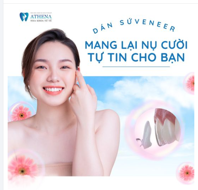 Dán sứ Veneer – Giải pháp cho nụ cười tự tin và tươi sáng