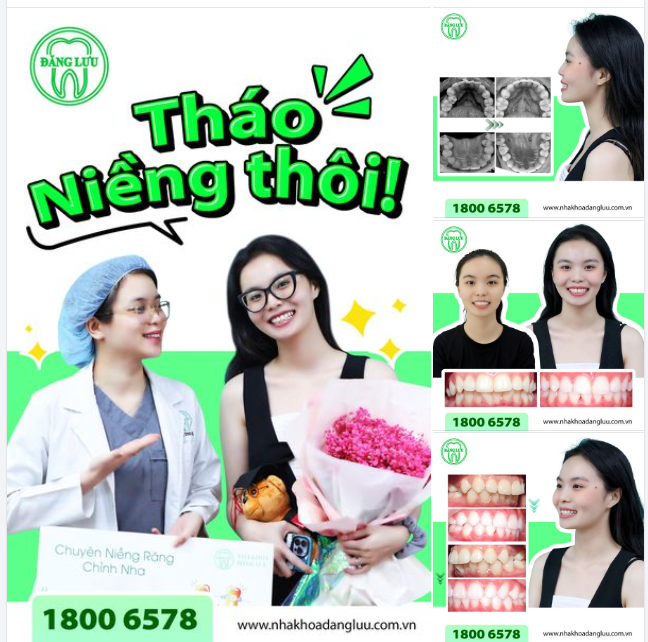 RĂNG XINH RỒI, THÁO NIỀNG THÔI!!!