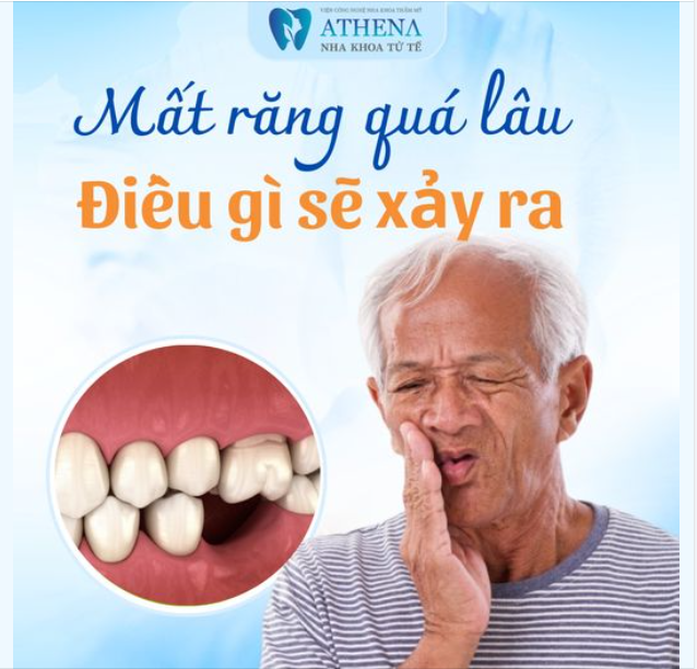 ĐỂ MẤT RĂNG QUÁ L U, ĐIỀU GÌ SẼ XẢY RA???