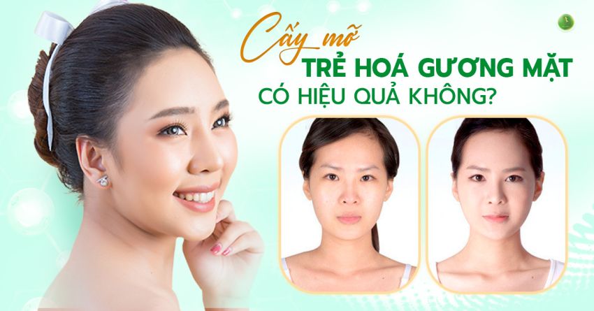 CẤY MỠ TRẺ HÓA GƯƠNG MẶT CÓ HIỆU QUẢ KHÔNG?